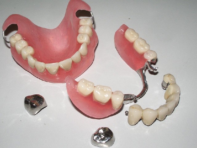 Протезирование зубов Стоматологическая клиника Дента Стар г Курган