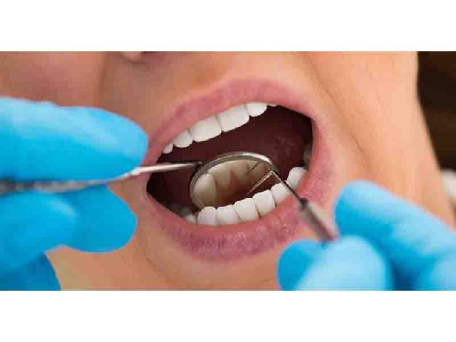 Эстетическая реставрация зубов Стоматологическая клиника Дента Стар г Курган