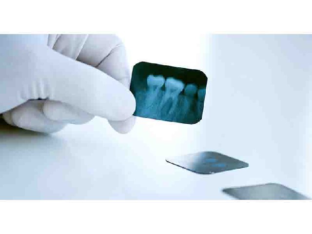 Рентген зубов в Кургане Стоматологическая клиника Дента Стар г Курган